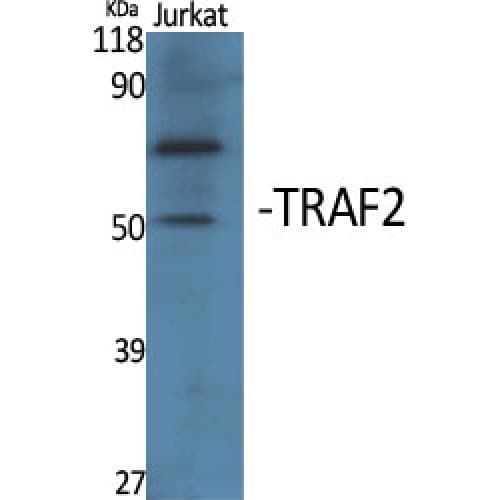 Polyclonal Rabbit anti-Human TRAF2 Antibody (Internal, IHC, WB)