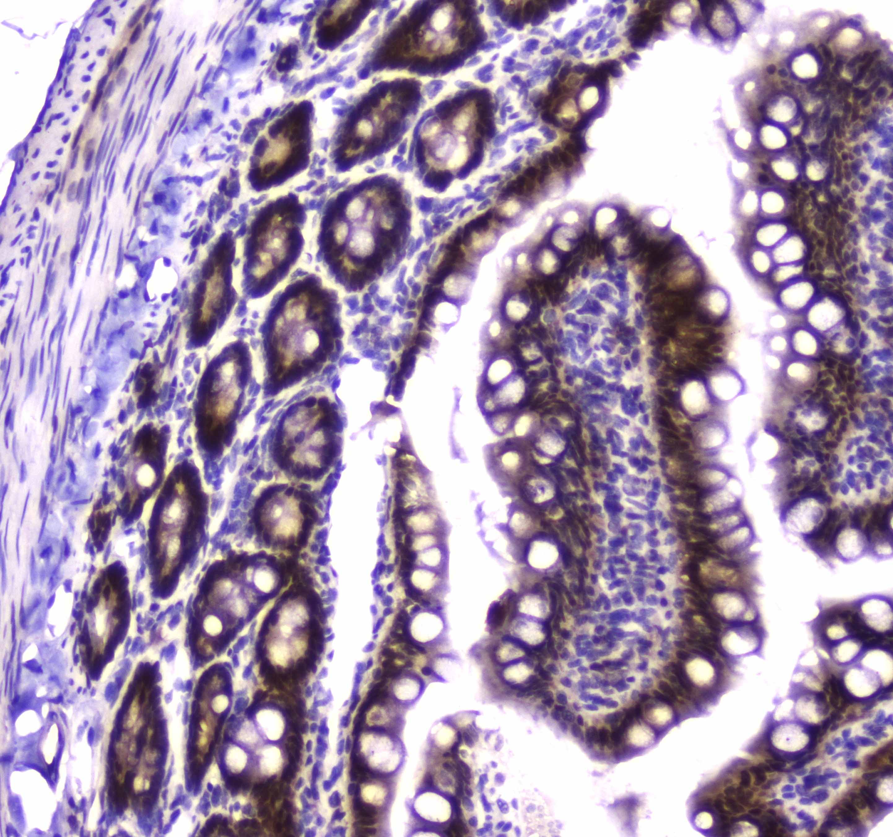 GSR / Glutathione Reductase Antibody