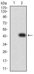 TEM1 / CD248 Antibody (clone 1H11A10)