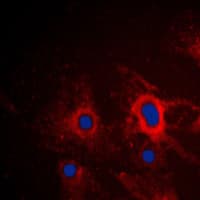 Polyclonal Rabbit anti-Human NOS2 / iNOS Antibody (C-Terminus, IHC, IF, WB)