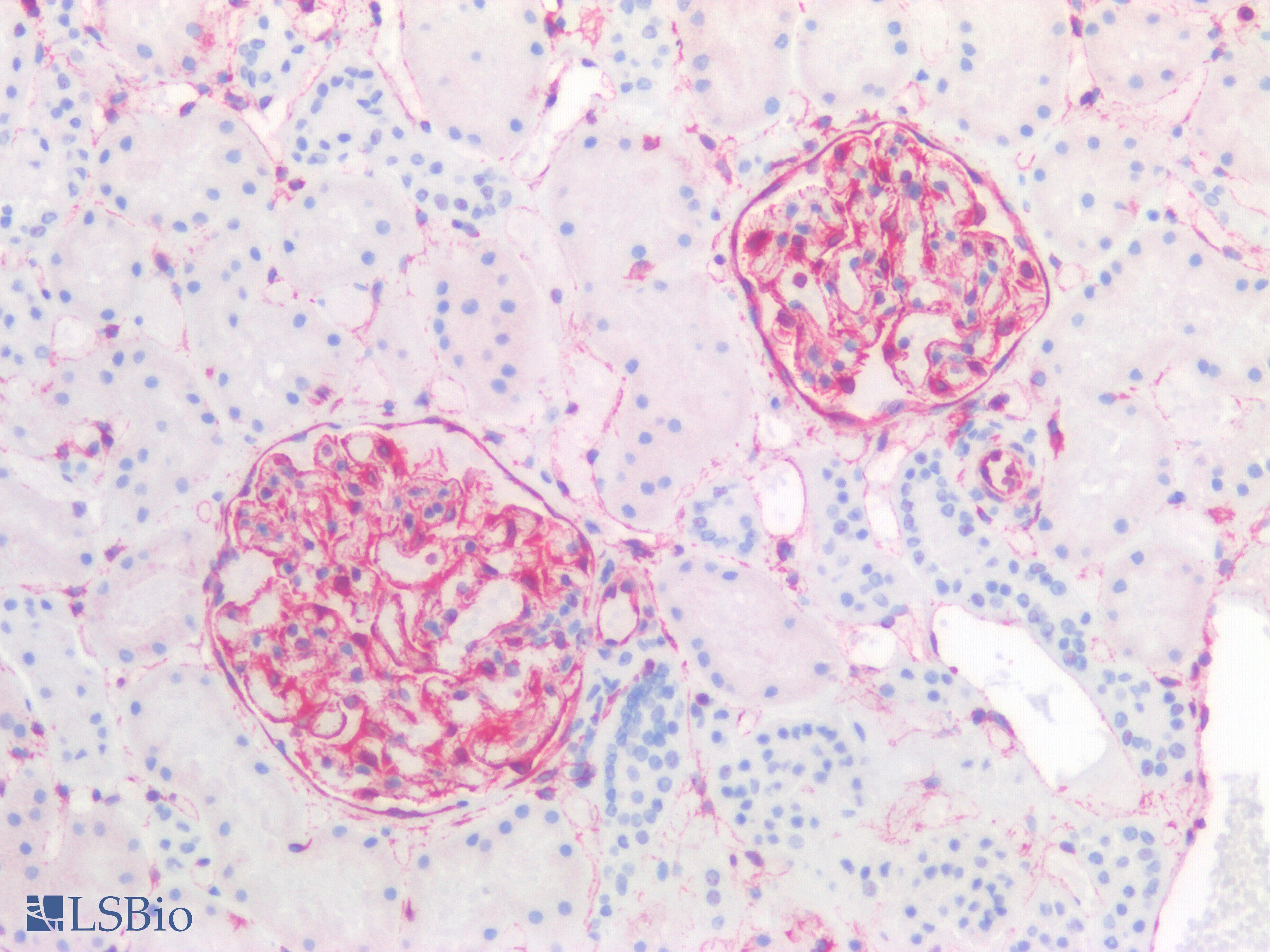 PathPlus™ Polyclonal Rabbit anti-Human Vimentin Antibody (IHC)