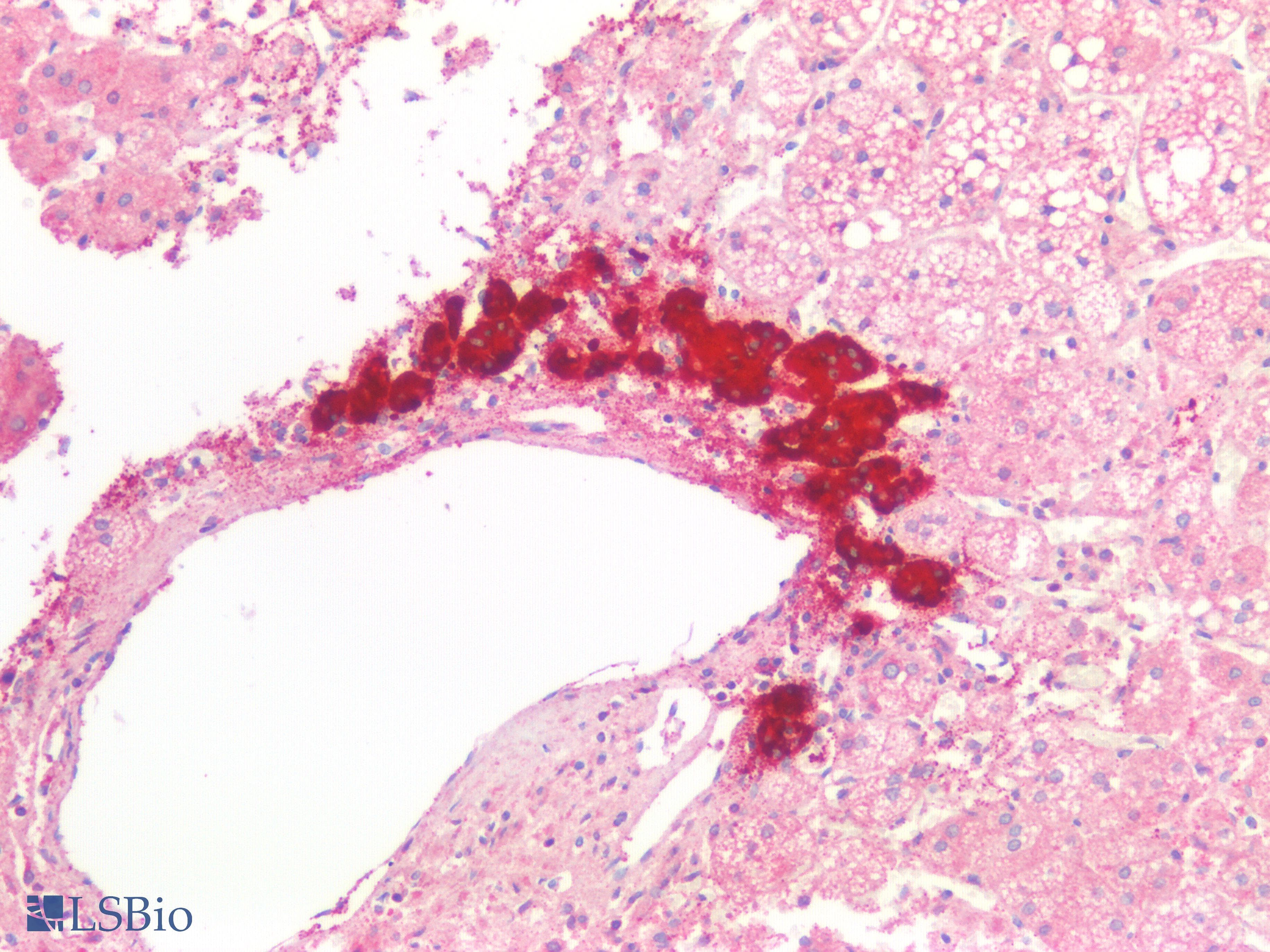 IHC-plus™ Polyclonal Rabbit anti-Human CHGA / Chromogranin A Antibody (Internal, IHC, WB)