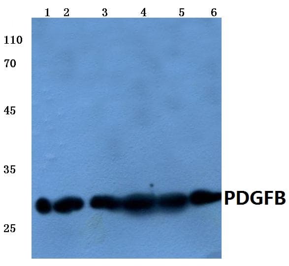 IHC-plus™ PDGF-BB Antibody (aa21-70)