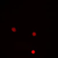 HMG20A Antibody