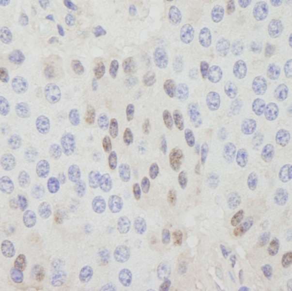 CDT1 Antibody (aa500-C-term)