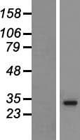 HLA-DRB5 Protein (Over-Expression Lysate Myc-DDK (Flag))