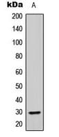 ABHD14A Antibody (C-Terminus)
