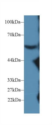 Complement C8b Antibody (aa161-503, HRP)