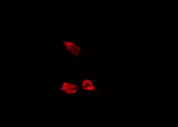 CAPNS1 / CAPN4 Antibody