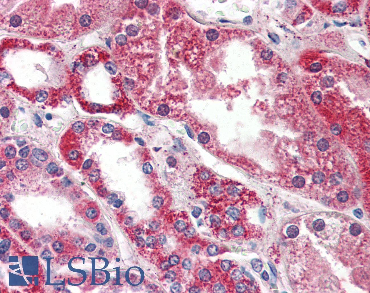 IHC-plus™ Monoclonal Mouse anti-Human PSPH Antibody (clone 3G12, aa1-225, IHC, WB)