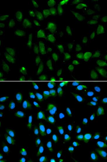 IHC-plus™ PSMA3 Antibody