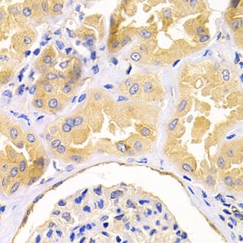 DUSP6 / MKP3 Antibody