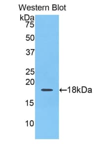 F8 / FVIII / Factor VIII Antibody (aa1854-1989)