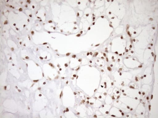 EXOSC1 / CSL4 Antibody (clone OTI1H9)