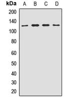Polyclonal Rabbit anti-Human EIF3B Antibody (WB)