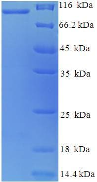 Rabbit MFI2 / p97 Protein (Recombinant His-SUMO)