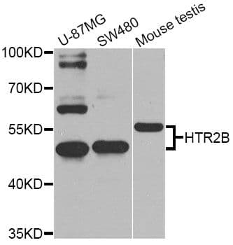 HTR2B / 5-HT2B Receptor Antibody