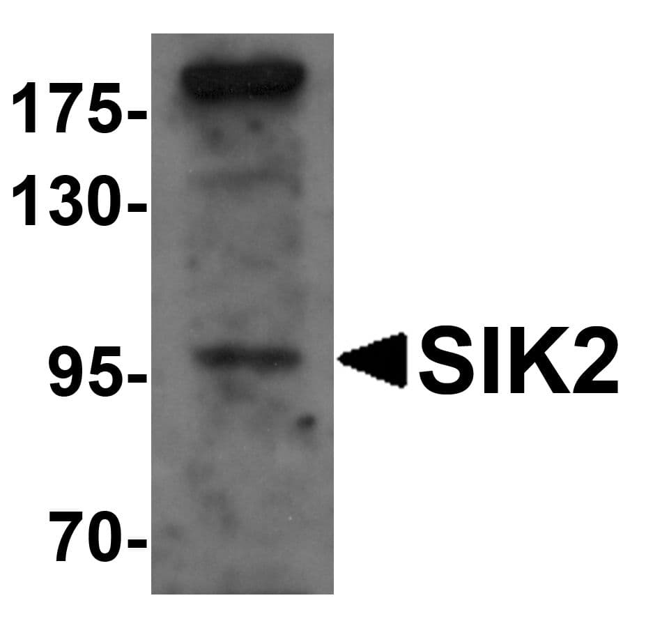 IHC-plus™ SIK2 / SNF1LK2 Antibody