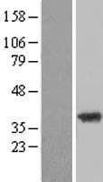ZADH2 Protein (Over-Expression Lysate Myc-DDK (Flag))