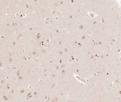 Polyclonal Rabbit anti-Human CKS2 Antibody (IHC, WB)