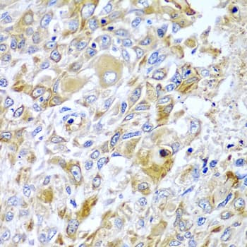 Polyclonal Rabbit anti-Human HAVCR2 / TIM-3 Antibody (aa22-202, IHC, WB)