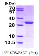 Human CITED2 Protein (Recombinant His)