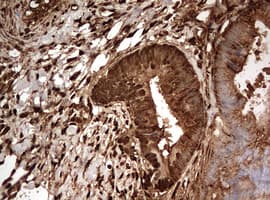 Monoclonal Mouse anti-Human GAPDH Antibody (clone OTI2F9, IHC, WB)