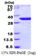 Human THG1L Protein (Recombinant His)