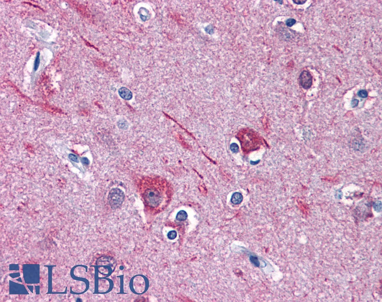PathPlus™ CAMK2A / CaMKII Alpha Antibody (aa455-468)