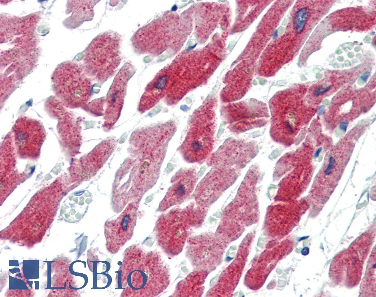 IHC-plus™ CRYAB / Alpha B Crystallin Antibody (clone 1B6.1-3G4)