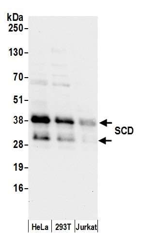 SCD1 / SCD Antibody (aa25-75)