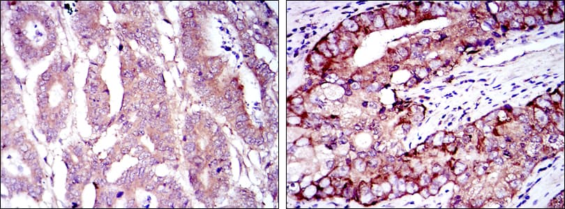 EIF4E Antibody (clone 5D11)