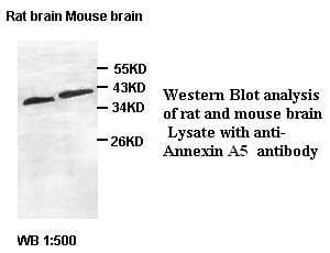 Polyclonal Rabbit anti-Human ANXA5 / Annexin V Antibody (IHC, WB)