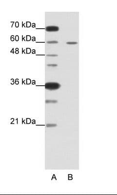 FZD5 / Frizzled 5 Antibody (C-Terminus)