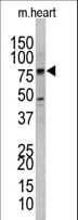 UVRAG Antibody (aa366-398)
