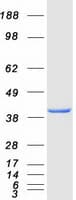 Human ALDOA / Aldolase A Protein (Recombinant Myc-DDK (Flag))