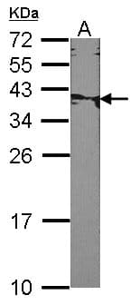 XRCC2 Antibody (aa1-123)