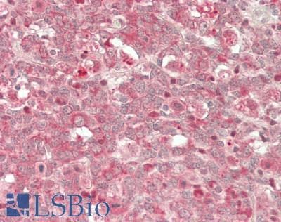 IHC-plus™ Polyclonal Rabbit anti-Human GAPDH Antibody (aa250-300, IHC, WB)