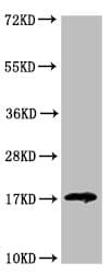 Polyclonal Rabbit anti-Human LGALS14 / CLC2 Antibody