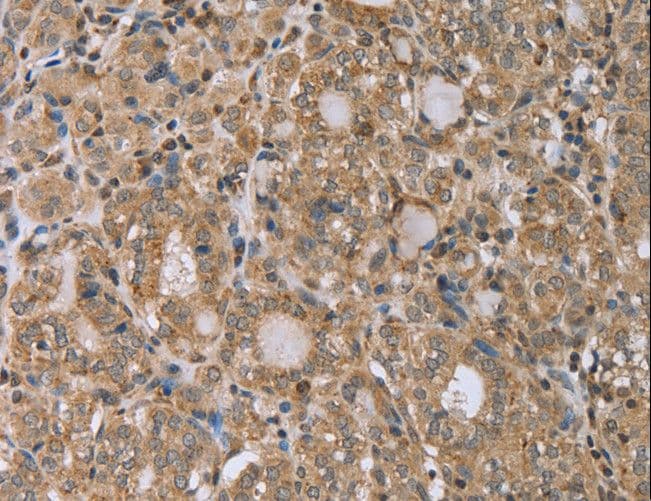 RAB39B Antibody