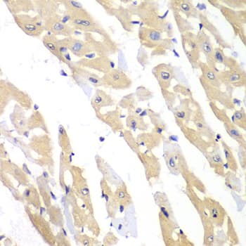 Polyclonal Rabbit anti-Human CCT3 Antibody (IHC, IF, WB)