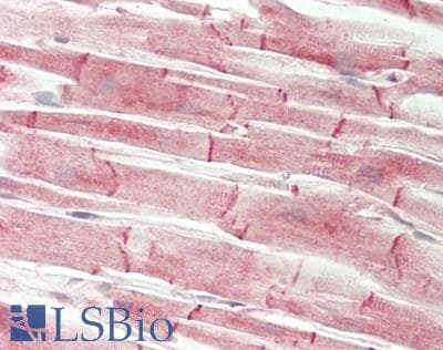 IHC-plus™ ARPC5 / p16-Arc Antibody (clone 2G1)