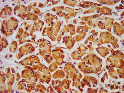 Polyclonal Rabbit anti-Human PTH / Parathyroid Hormone Antibody (WB)