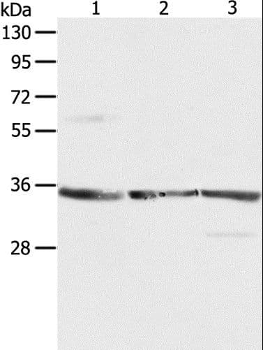 RPLP0 Antibody