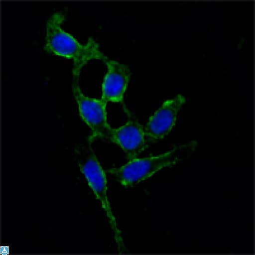 FAK / Focal Adhesion Kinase Antibody