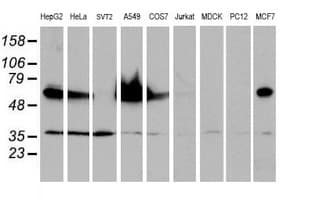 EPN2 Antibody (clone OTI1G3, Carrier-free)