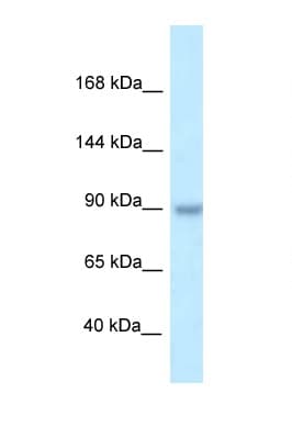 Polyclonal Rabbit anti-Human TBC1D2B Antibody (aa570-619, WB)