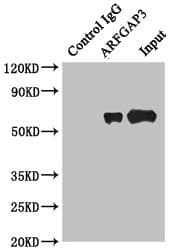 Polyclonal Rabbit anti-Human ARFGAP3 Antibody (aa217-516, IHC, WB)