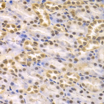 KDM1A / LSD1 Antibody