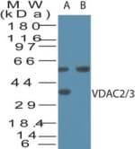 Polyclonal Rabbit anti-Human VDAC2+3 Antibody (aa120-132, WB)